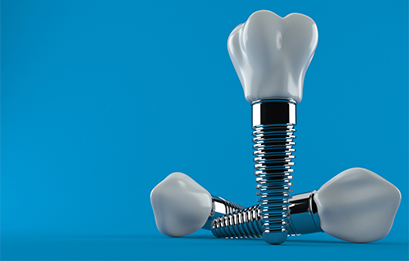 Dental Implant - Dentagross